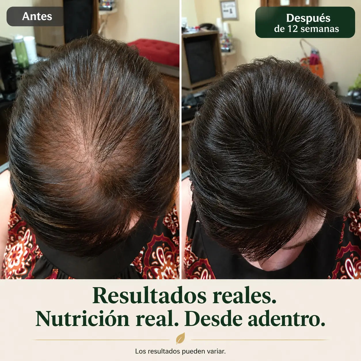 Advanced Hair Growth | Rainbow Nutrients| 120 Capsulas